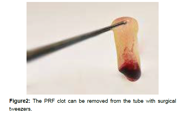 regenerative-medicine-surgical-tweezers regenerative-medicine-surgical-tweezers