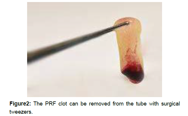 regenerative-medicine-surgical-tweezers