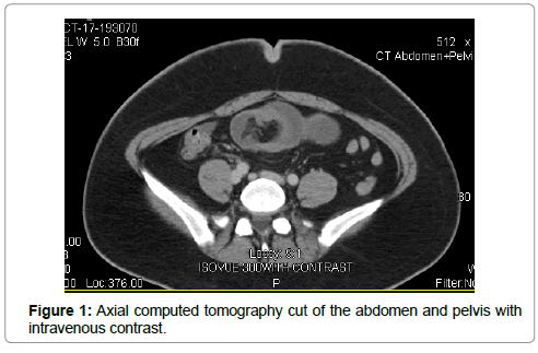 reports-gastroenterology-Axial-computed