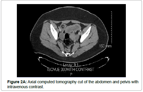 reports-gastroenterology-Axial-tomography