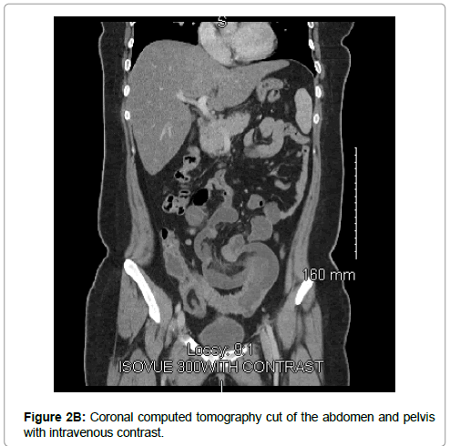 reports-gastroenterology-Coronal-tomography