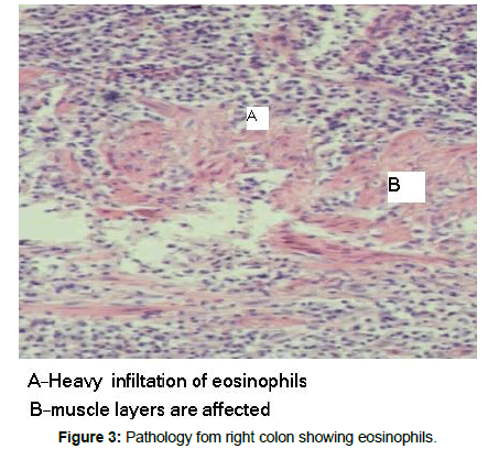 reports-gastroenterology-Pathology-colon