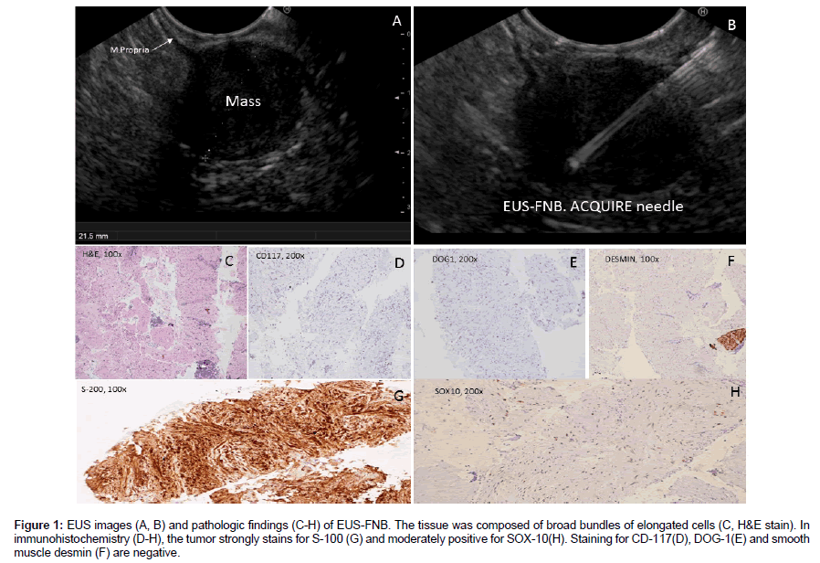 research-reports-gastroenterology-EUS-images