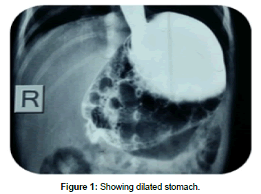 research-reports-gastroenterology-dilated-stomach