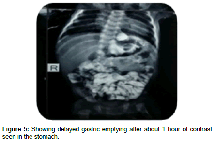 research-reports-gastroenterology-gastric-emptying
