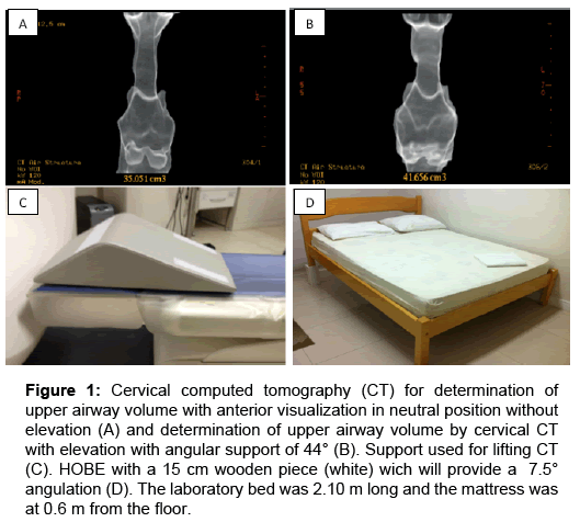 sleep-disorders-computed-tomography