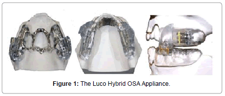 sleep-disorders-treatment-care-OSA-Appliance