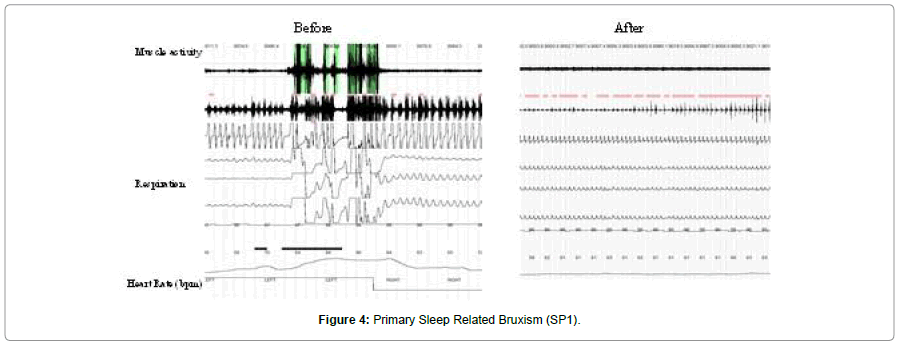 sleep-disorders-treatment-care-Primary-Sleep