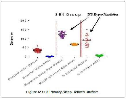 sleep-disorders-treatment-care-Related-Bruxism