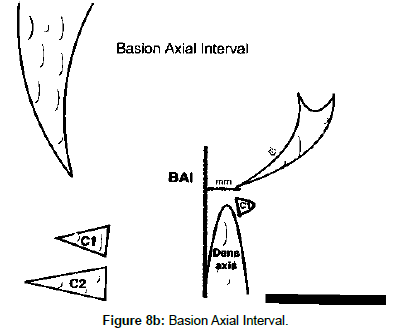 spine-neurosurgery-Basion-Axial