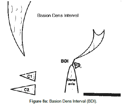 spine-neurosurgery-Basion-Dens