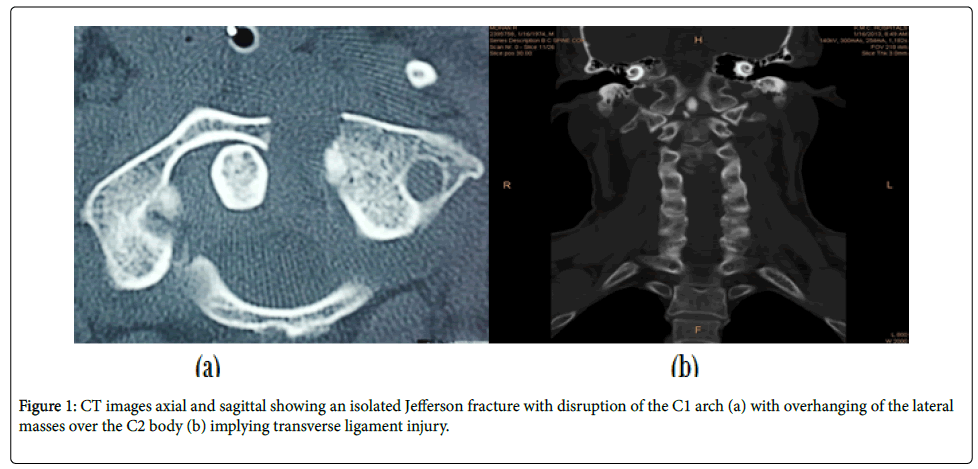spine-neurosurgery-CT-images