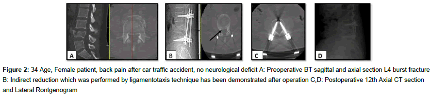 spine-neurosurgery-Female-patient