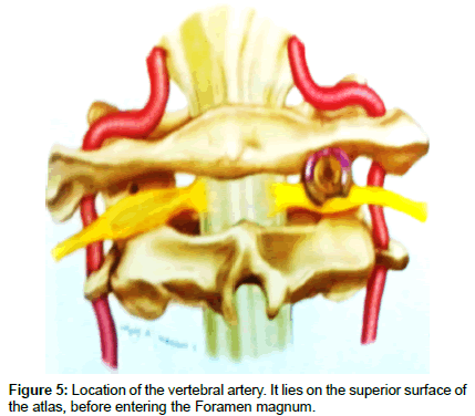 spine-neurosurgery-Foramen-magnum
