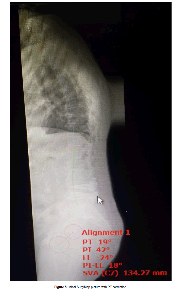 spine-neurosurgery-Initial-SurgiMap