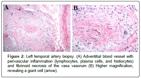 spine-neurosurgery-Left-temporal