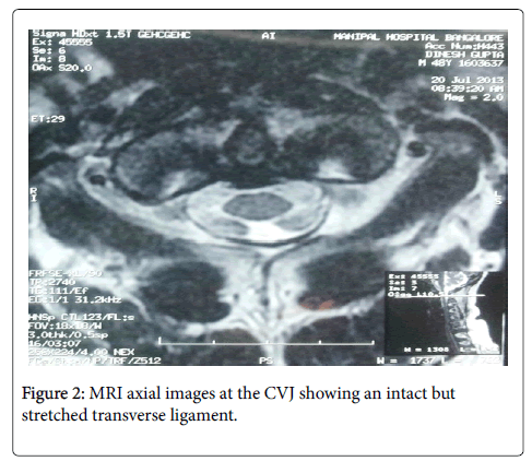 spine-neurosurgery-MRI-axial