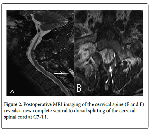 spine-neurosurgery-MRI-imaging