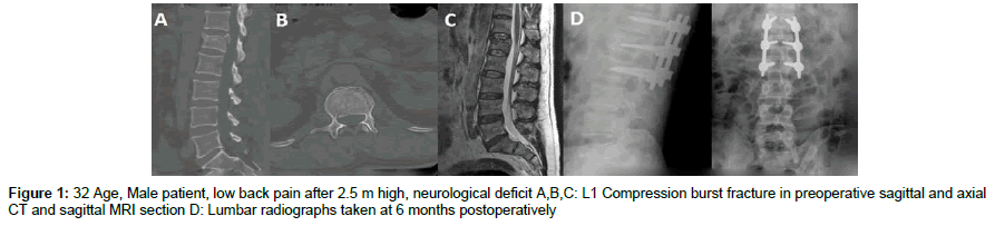 spine-neurosurgery-Male-patient