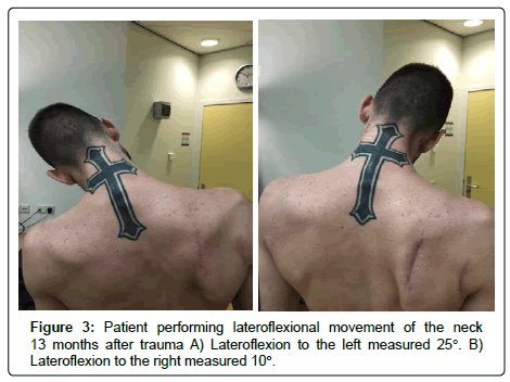 spine-neurosurgery-Patient-performing