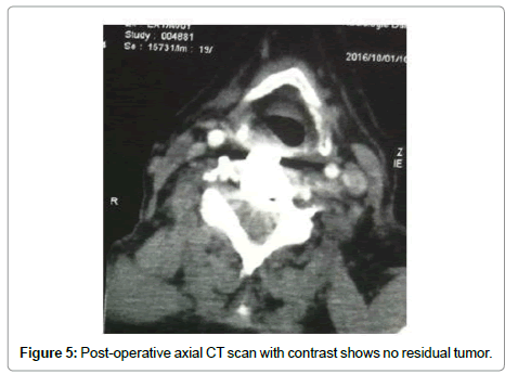 spine-neurosurgery-Post-operative-axial