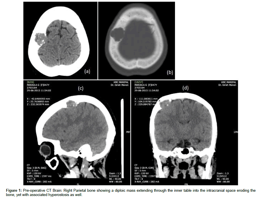 spine-neurosurgery-Right-Parietal