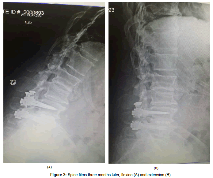 spine-neurosurgery-Spine-films