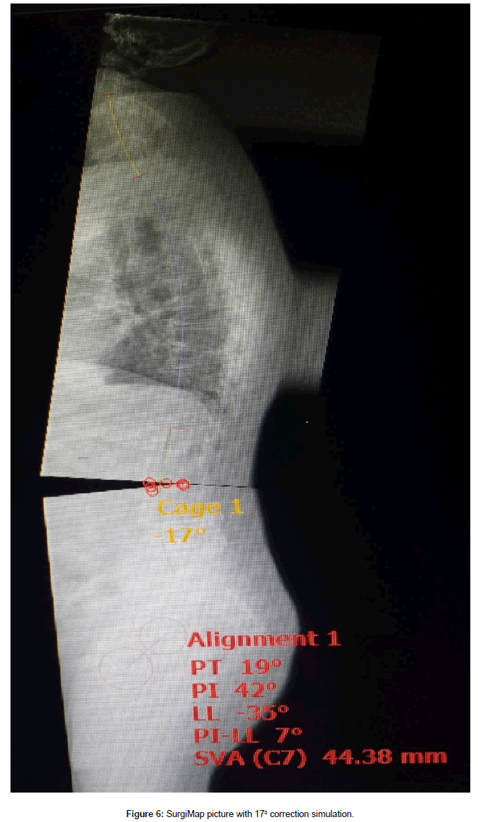 spine-neurosurgery-SurgiMap