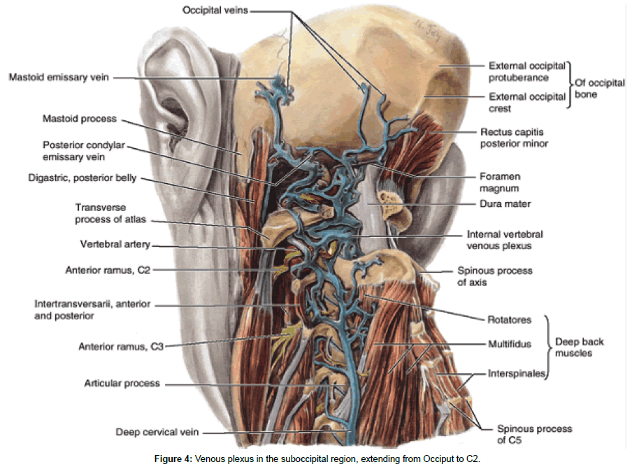 Cranio Cervical Trauma Eidemiology Classification Diagnosis And Management Scitechnol