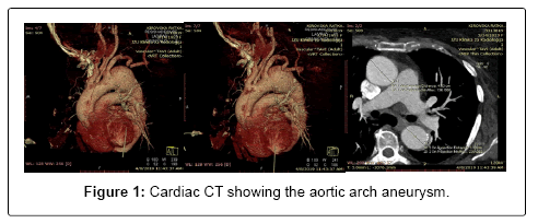 spine-neurosurgery-aneurysm spine-neurosurgery-aneurysm