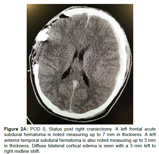 spine-neurosurgery-anterior-temporal
