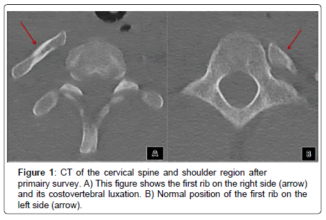 spine-neurosurgery-cervical-spine