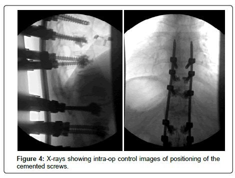 spine-neurosurgery-control-images