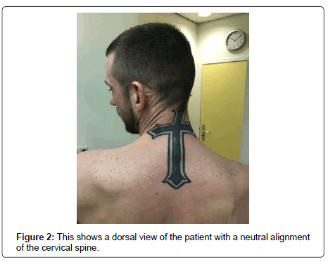 spine-neurosurgery-dorsal-view