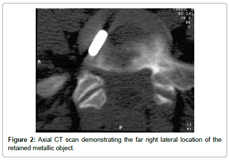 spine-neurosurgery-lateral-location