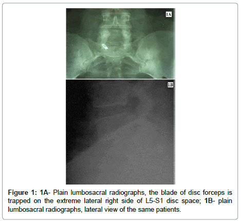 spine-neurosurgery-lumbosacral-radiographs