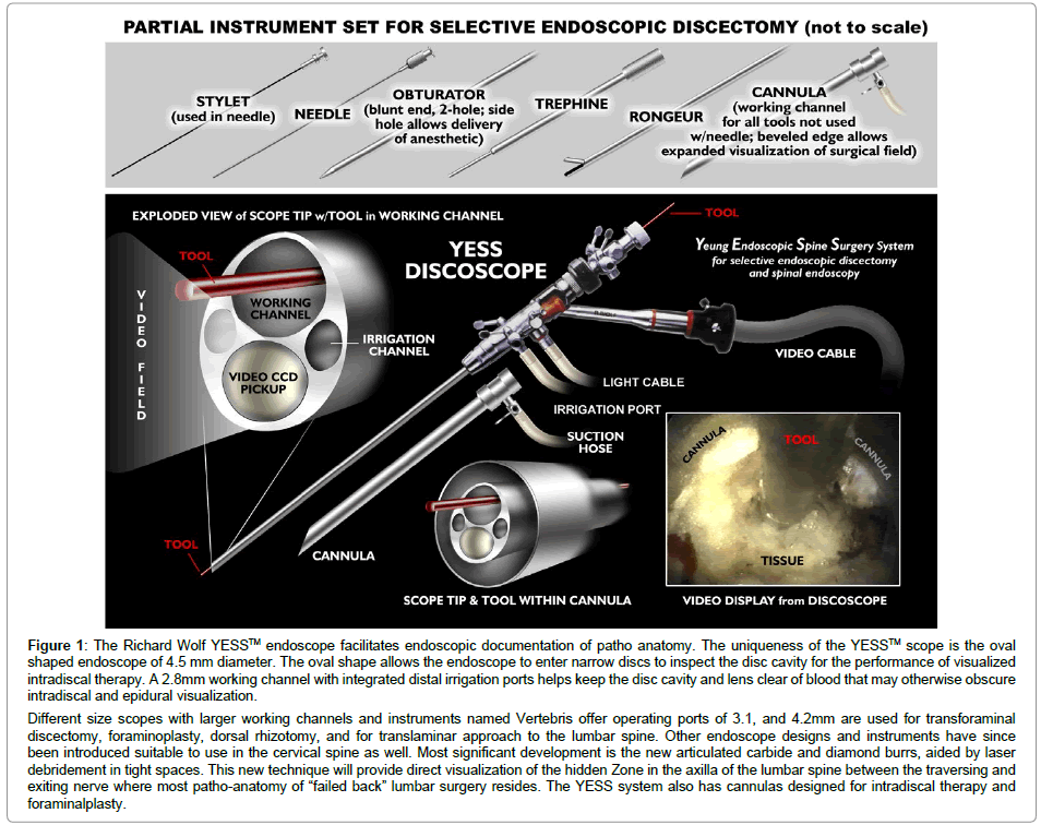 spine-neurosurgery-patho-anatomy