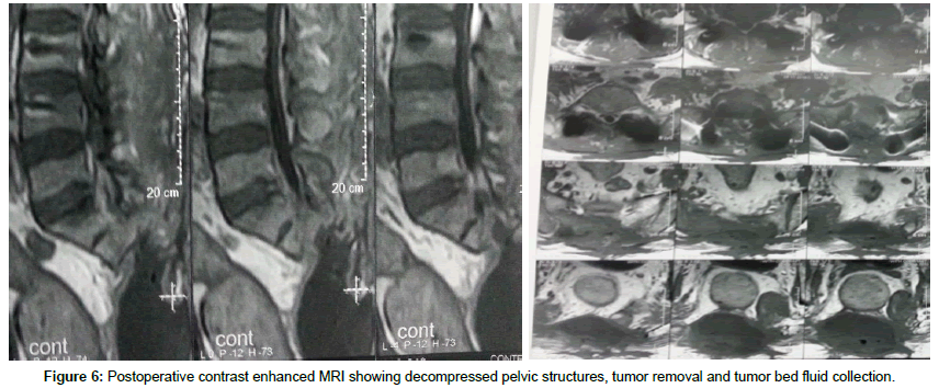 spine-neurosurgery-pelvic-structures