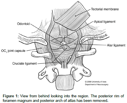 spine-neurosurgery-posterior-arch