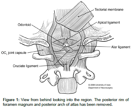 Cranio Cervical Trauma Eidemiology Classification Diagnosis And Management Scitechnol