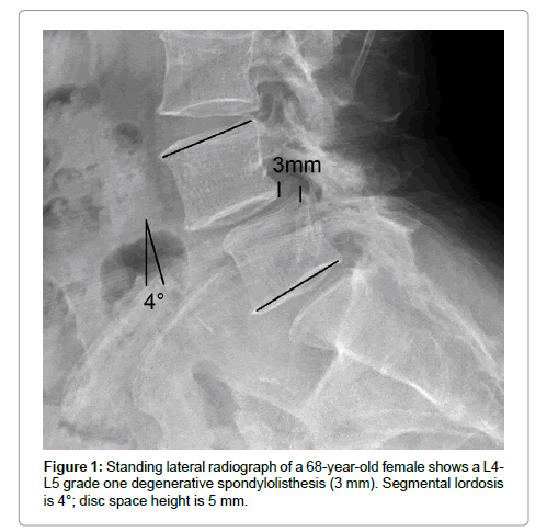 spine-neurosurgery-radiograph