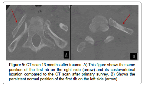 spine-neurosurgery-right-side