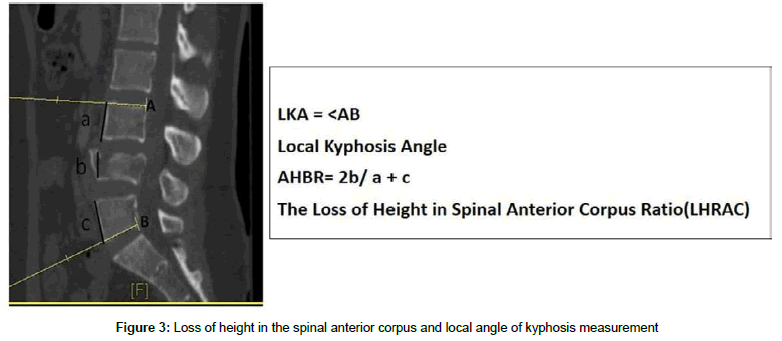spine-neurosurgery-spinal-anterior