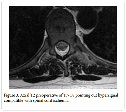 spine-neurosurgery-spinal-cord