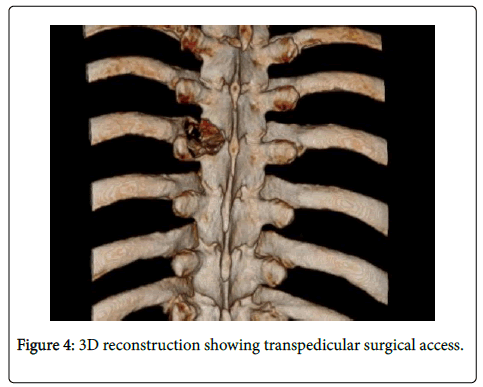 spine-neurosurgery-surgical-access