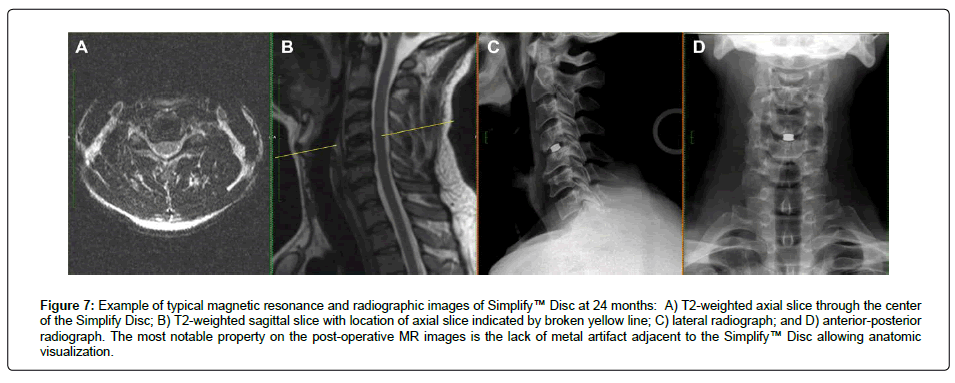 spine-neurosurgery-typical-magnetic
