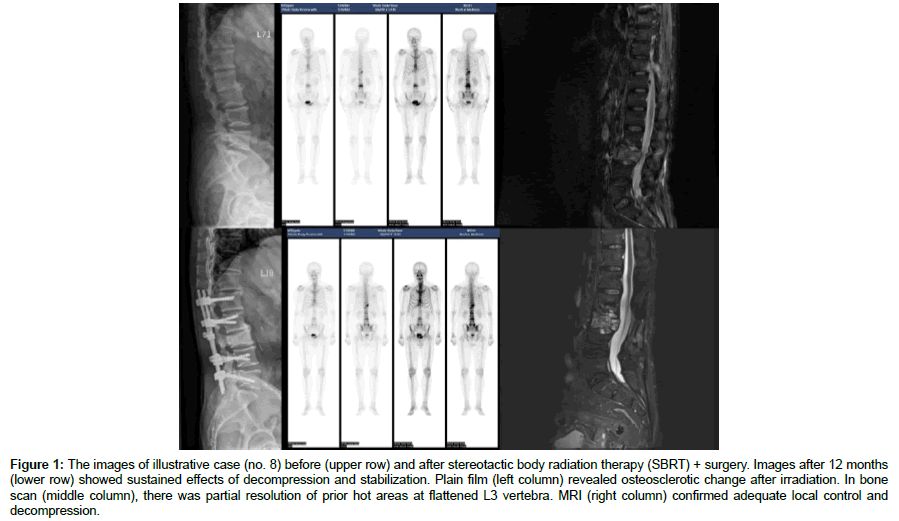 spine-neurosurgery-upper-row