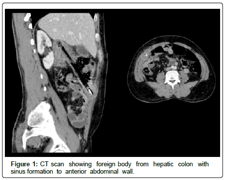 surgery-clinical-practice-CT-scan