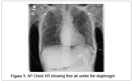 surgery-clinical-practice-Chest-XR