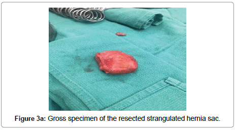 surgery-clinical-practice-Gross-specimen